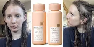 Kristin Ess Resolves Major Lawsuit While Consumer Hair Loss Claims Surface