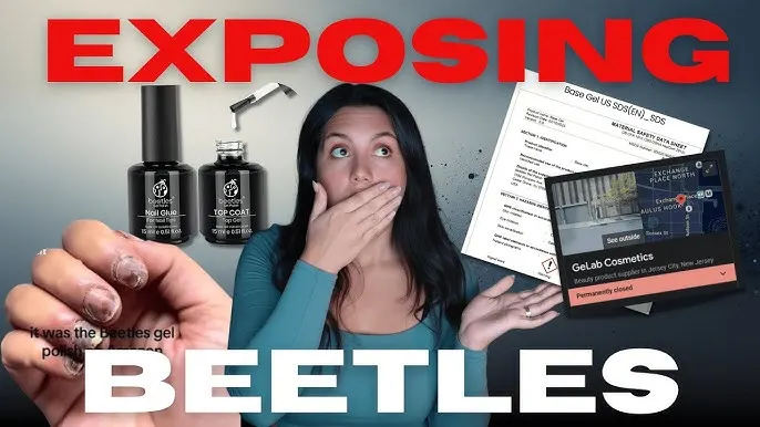 Beetles Gel Polish Lawsuit? The Viral Allergy Outbreak Fueling Calls for Action — The Truth Behind TikTok’s Explosive Reactions