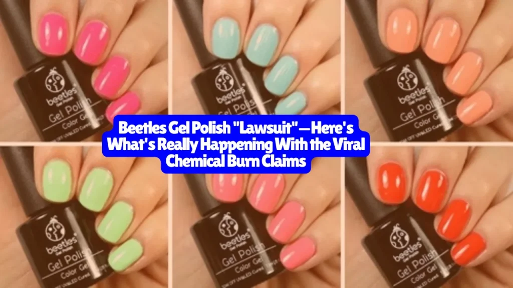 Beetles Gel Polish Lawsuit—Here's What's Really Happening With the Viral Chemical Burn Claims