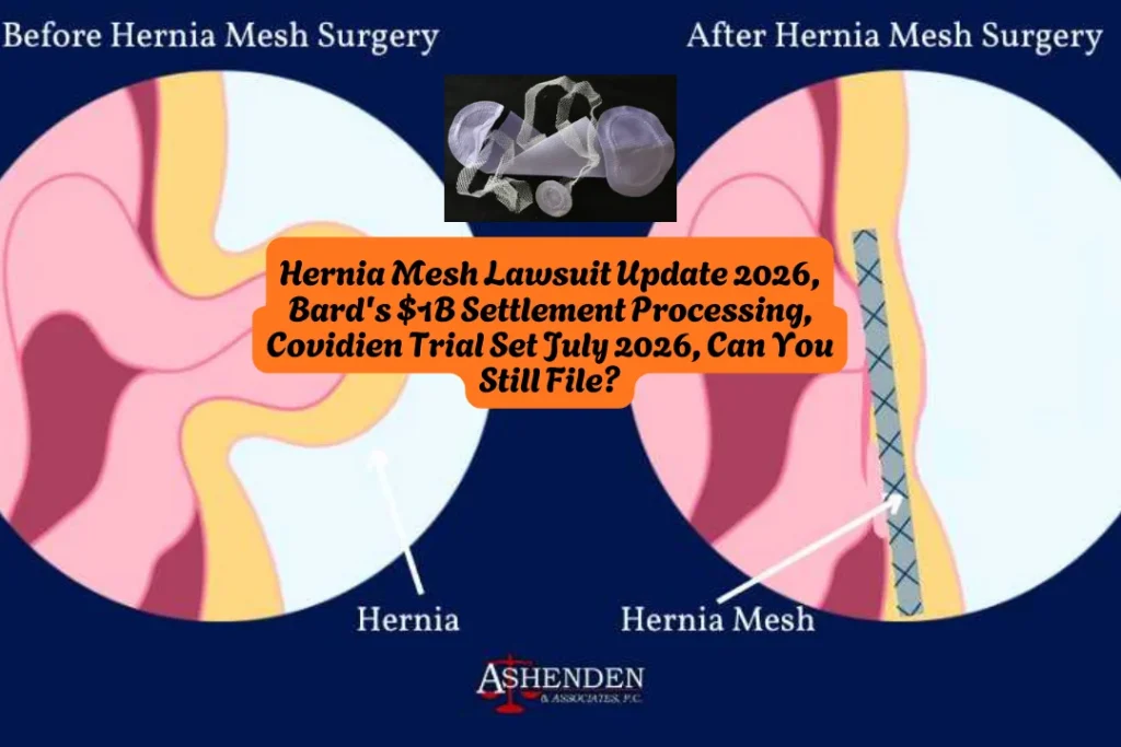 Hernia Mesh Lawsuit Update 2026, Bard's $1B Settlement Processing, Covidien Trial Set July 2026, Can You Still File?