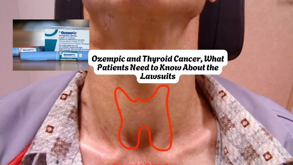 Ozempic and Thyroid Cancer, What Patients Need to Know About the Lawsuits