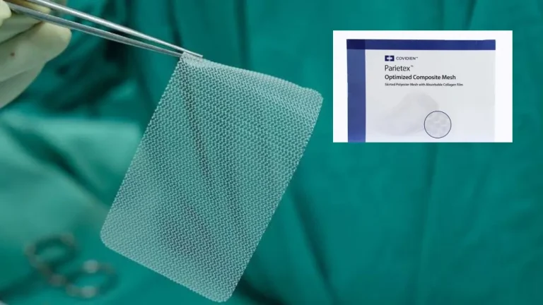 Covidien Hernia Mesh Lawsuit, Were You Affected