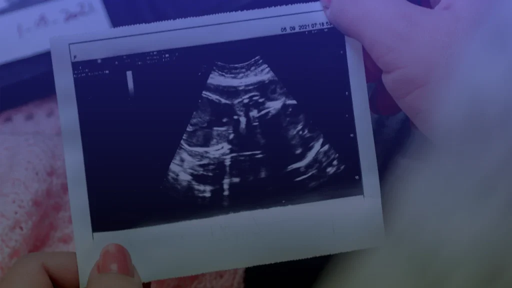 Wabbington v. Boyd, $200,000 Wrongful Death Settlement Paid to Baby Wabbington's Estate in New Mexico